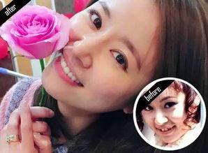 小牙齿明星,闪耀童心的璀璨星河